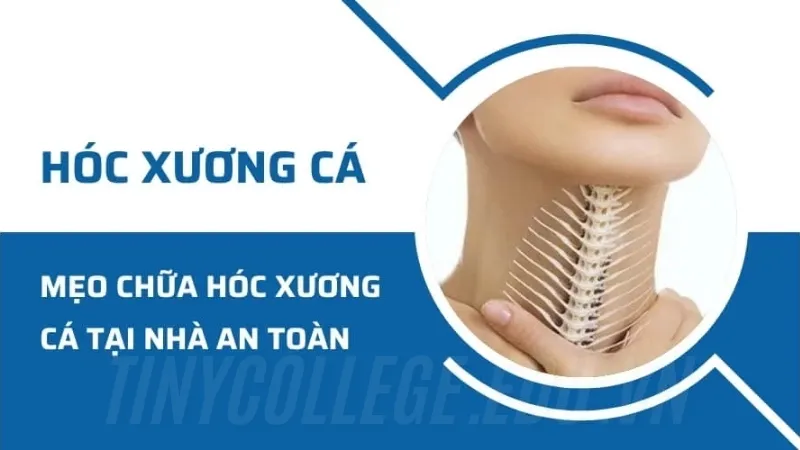 Bị hóc xương cá phải làm như thế nào? Cách xử lý nhanh chóng 6