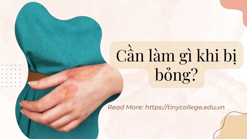 Cần làm gì khi bị bỏng - Các biện pháp cấp cứu khẩn cấp 1