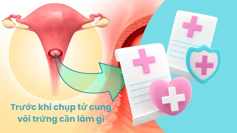 Trước khi chụp tử cung vòi trứng cần làm gì? Lưu ý quan trọng 1