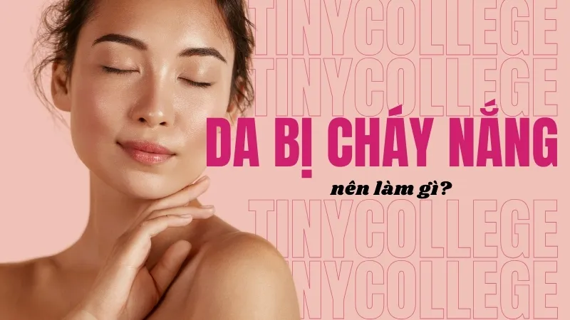 Da bị cháy nắng nên làm gì? Hướng dẫn chăm sóc da hiệu quả 1