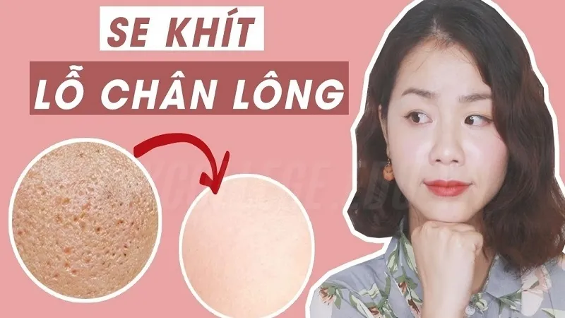 Lỗ chân lông to nên làm gì? Top 6 cách trị hiệu quả 6