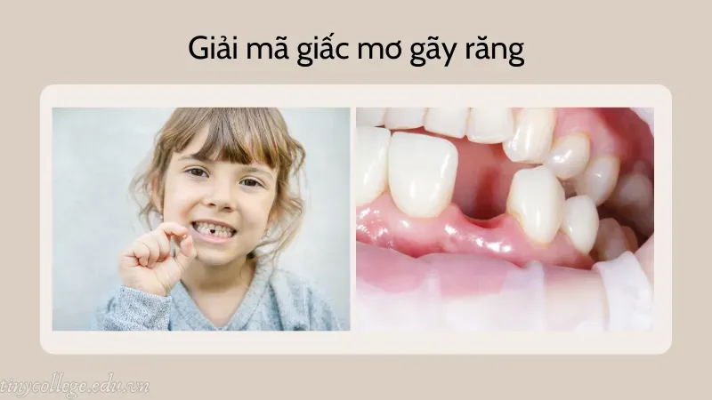 nằm mơ gãy răng báo hiệu điều gì 4