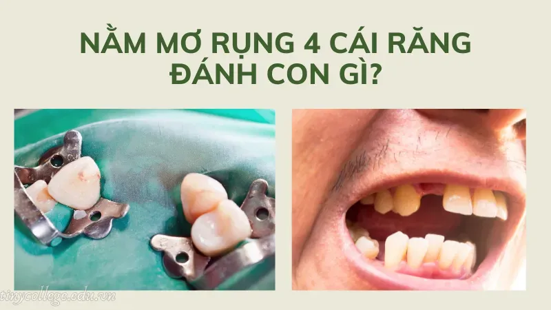 nằm mơ rụng 4 cái răng 3