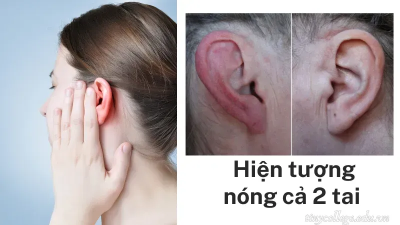 nóng cả 2 tai là điềm gì 1