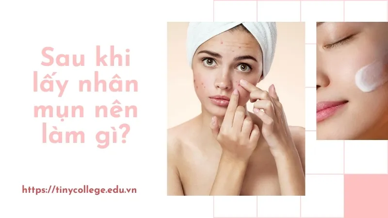 Sau khi lấy nhân mụn nên làm gì? Biện pháp chăm sóc da hiệu quả 1