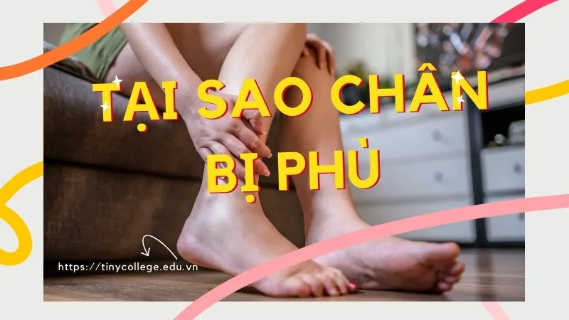 Tại sao chân bị phù? Dấu hiệu cảnh báo sức khỏe bạn cần lưu ý 1