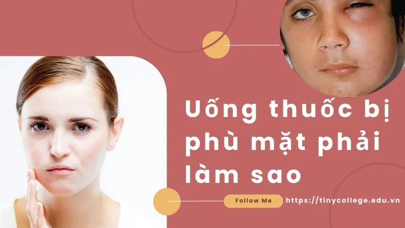 Uống thuốc bị phù mặt phải làm sao? Giải pháp hiệu quả 1