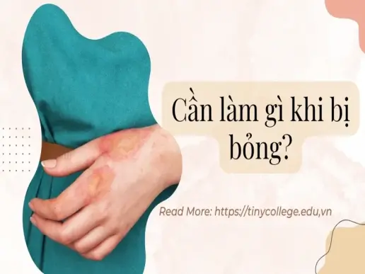 Cần làm gì khi bị bỏng - Các biện pháp cấp cứu khẩn cấp