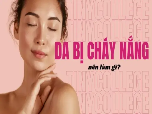 Da bị cháy nắng nên làm gì? Hướng dẫn chăm sóc da hiệu quả