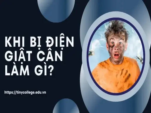 Khi bị điện giật cần làm gì? Hướng dẫn sơ cứu chi tiết