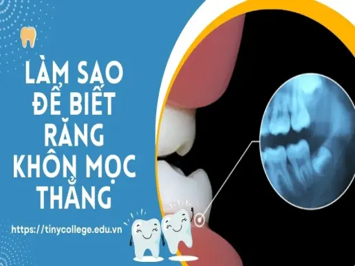 Làm sao để biết răng khôn mọc thẳng? Những điều cần chú ý