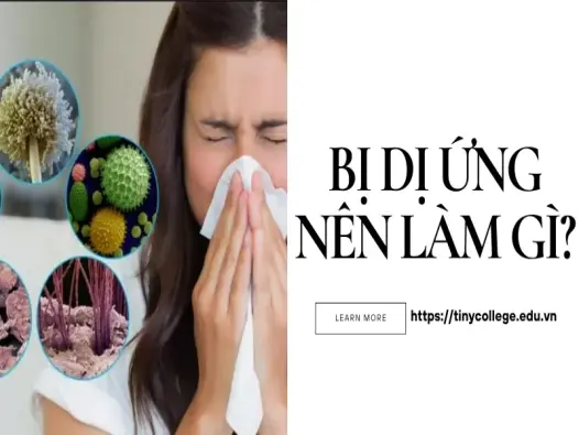 Bị dị ứng nên làm gì? Các phương pháp khắc phục hiệu quả