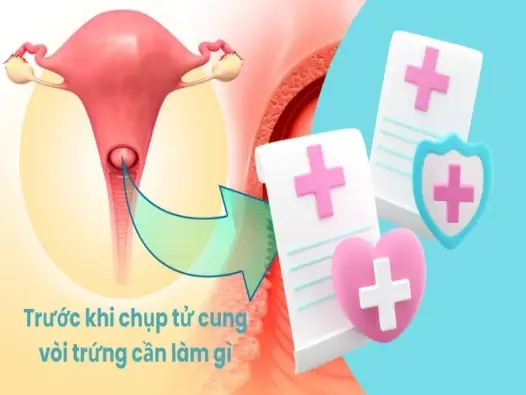 Trước khi chụp tử cung vòi trứng cần làm gì? Lưu ý quan trọng