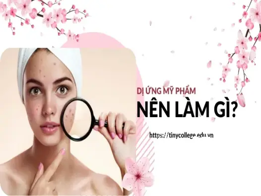 Bị dị ứng mỹ phẩm nên làm gì? Hướng dẫn chi tiết từng bước