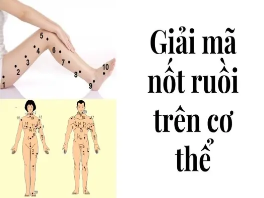 Giải mã nốt ruồi trên cơ thể hé lộ vận mệnh giàu sang
