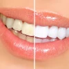 Bật mí mẹo làm trắng răng tại nhà hiệu quả, an toàn và tiết kiệm