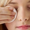 Mẹo Chữa Lẹo Mắt Bằng Đũa: Hiệu Quả Hay Chỉ Là Truyền Miệng?