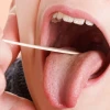 Mẹo Chữa Viêm Amidan Hốc Mủ Tại Nhà Hiệu Quả Không Cần Thuốc