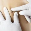 Mẹo dân gian chữa u bã đậu: An toàn hay tiềm ẩn rủi ro?