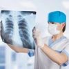 Tư vấn điều trị ung thư phổi hiệu quả theo phác đồ phù hợp