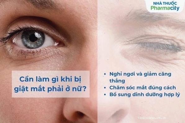 Các biện pháp chăm sóc mắt để giảm giật mí