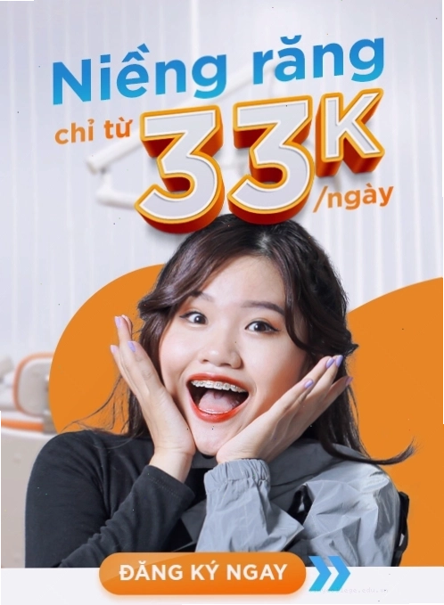 Các loại mắc cài niềng răng phổ biến
