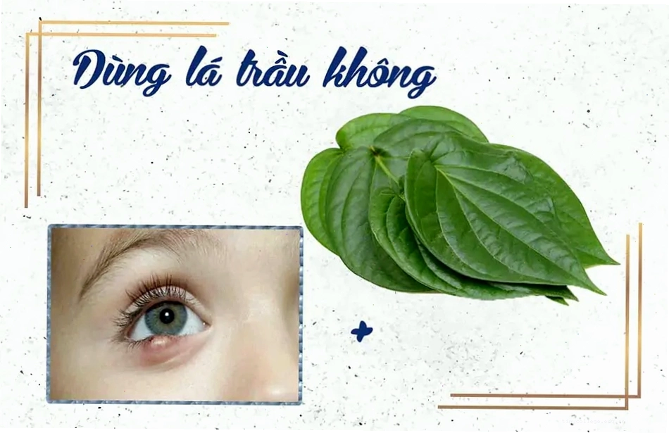 Cách chữa lẹo mắt bằng lá trầu không