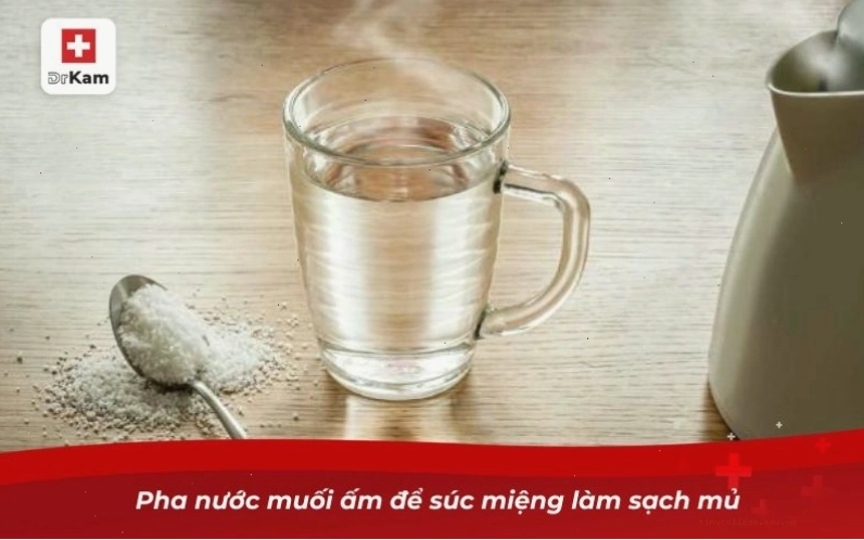 Cách chữa viêm amidan hốc mủ bằng nước muối ấm
