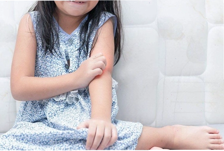 Cách trị nổi mề đay cho trẻ đúng và kịp thời đóng vai trò rất quan trọng