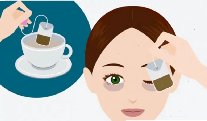 Chườm túi trà lọc để làm dịu cơn đau và giảm sưng lẹo mắt