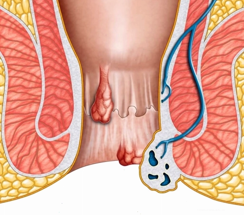 Hình ảnh minh họa cấu trúc trực tràng và hậu môn