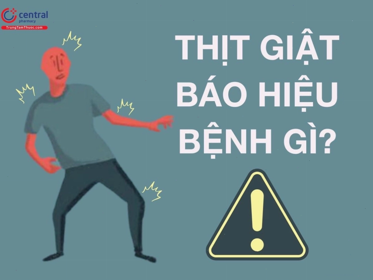 Hình ảnh minh họa tổn thương dây thần kinh gây thịt giật