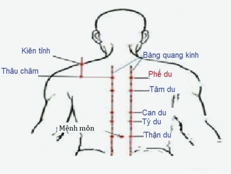 Lẹo mắt là tình trạng viêm nhiễm ở bờ mi mắt do vi khuẩn