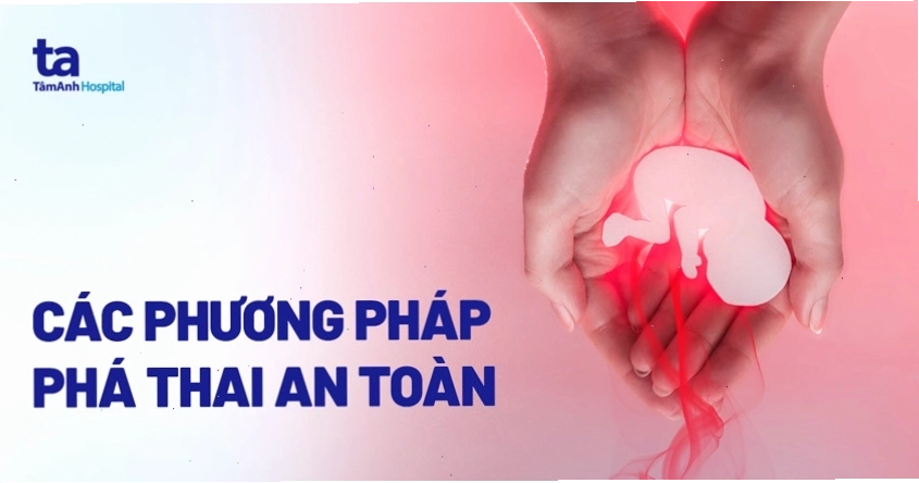 Minh họa phương pháp phá thai an toàn bằng thuốc