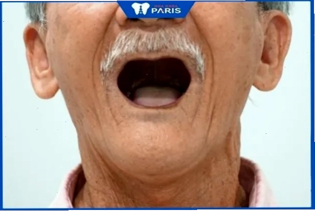 Mơ rụng hết răng là điềm báo về sự mất mát lớn trong cuộc sống