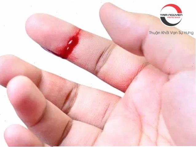 Mơ thấy bị chảy máu từ vết thương là điềm gì?