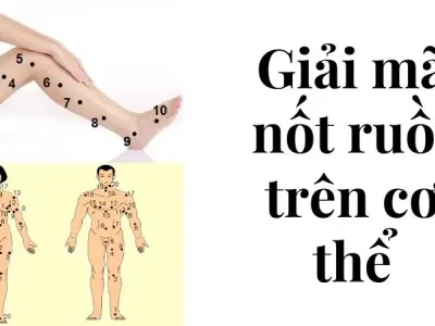 Giải mã nốt ruồi trên cơ thể hé lộ vận mệnh giàu sang