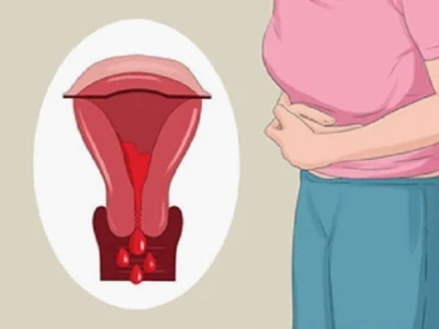 10 mẹo giảm đau bụng kinh hiệu quả tại nhà