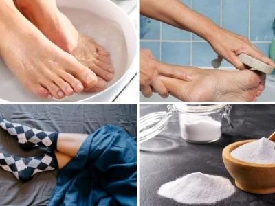 Bí quyết vàng: 12 mẹo chữa bong da chân tại nhà hiệu quả