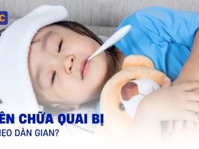 Chữa Quai Bị Bằng Mẹo Dân Gian: Hiệu Quả Hay Chỉ Là Tin Đồn?