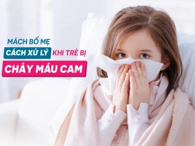 Mẹo Chữa Chảy Máu Cam Ở Trẻ Em Nhanh Chóng Và Hiệu Quả Tại Nhà