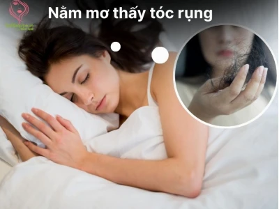 Nằm mơ thấy rụng tóc là điềm gì? Giải mã giấc mơ và con số may mắn
